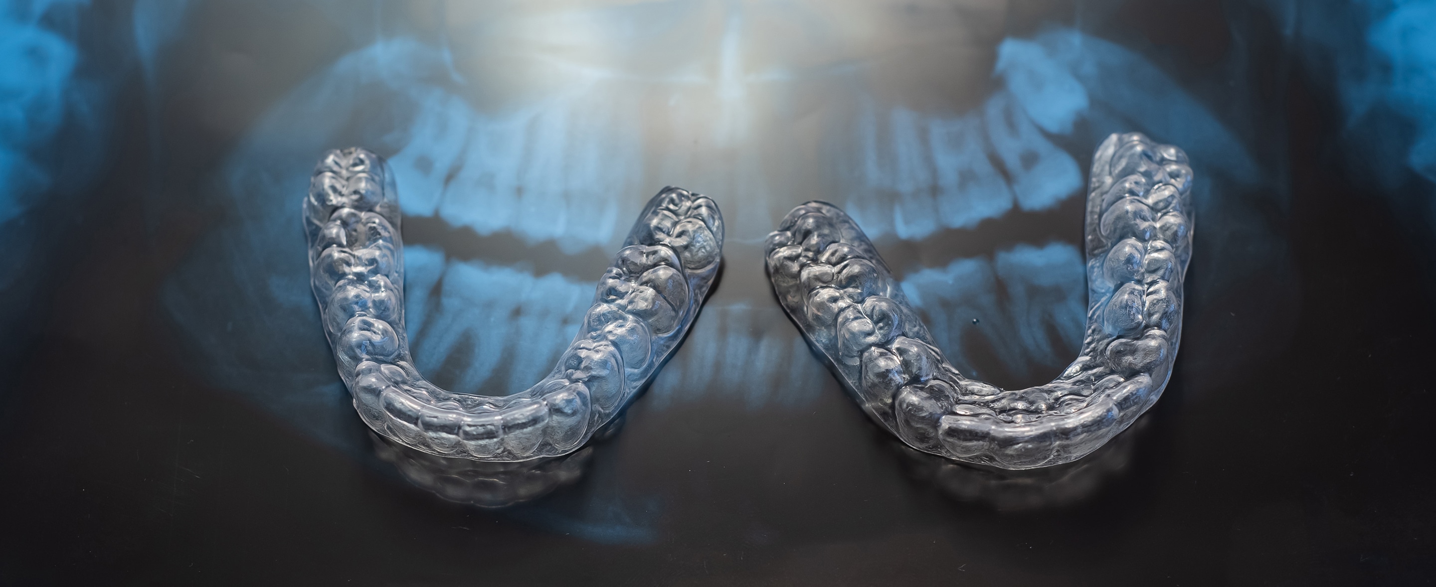 Как повысить лояльность пациентов  с помощью прозрачных элайнеров: 5 советов